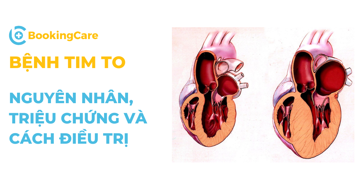 Bệnh tim to: Nguyên nhân, triệu chứng và cách điều trị 